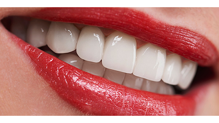 Имплантация Зубов Без Разреза Десны. Как Это?